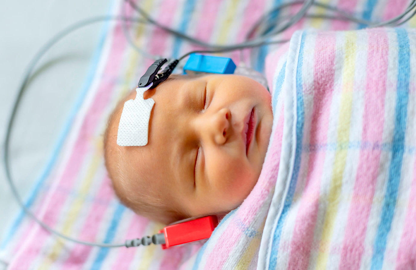 Image of a newborn baby in bassenet with hearing testing device on their head.